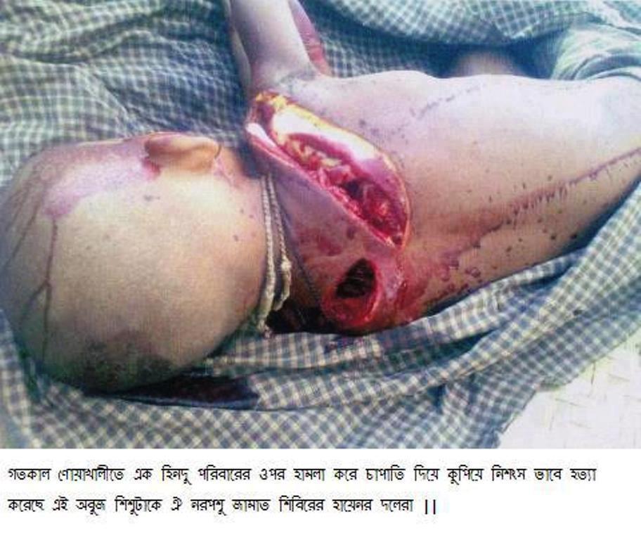 Supporters of Sayeede, Jammati Islamic beasts chopped to kill this innocent Hindu Child in Noakhali (Bangladesh) yesterday. What was the sin of this innocent Hindu Child? O Islamic Rioters, Please give me the answer?