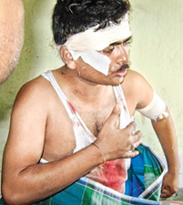 Brutally injured Hindu Cop  Jayanta Poddar by an Islamist's Razor