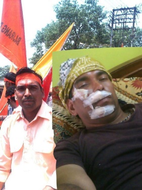 Bajrangdal Activist Severely beaten by Police